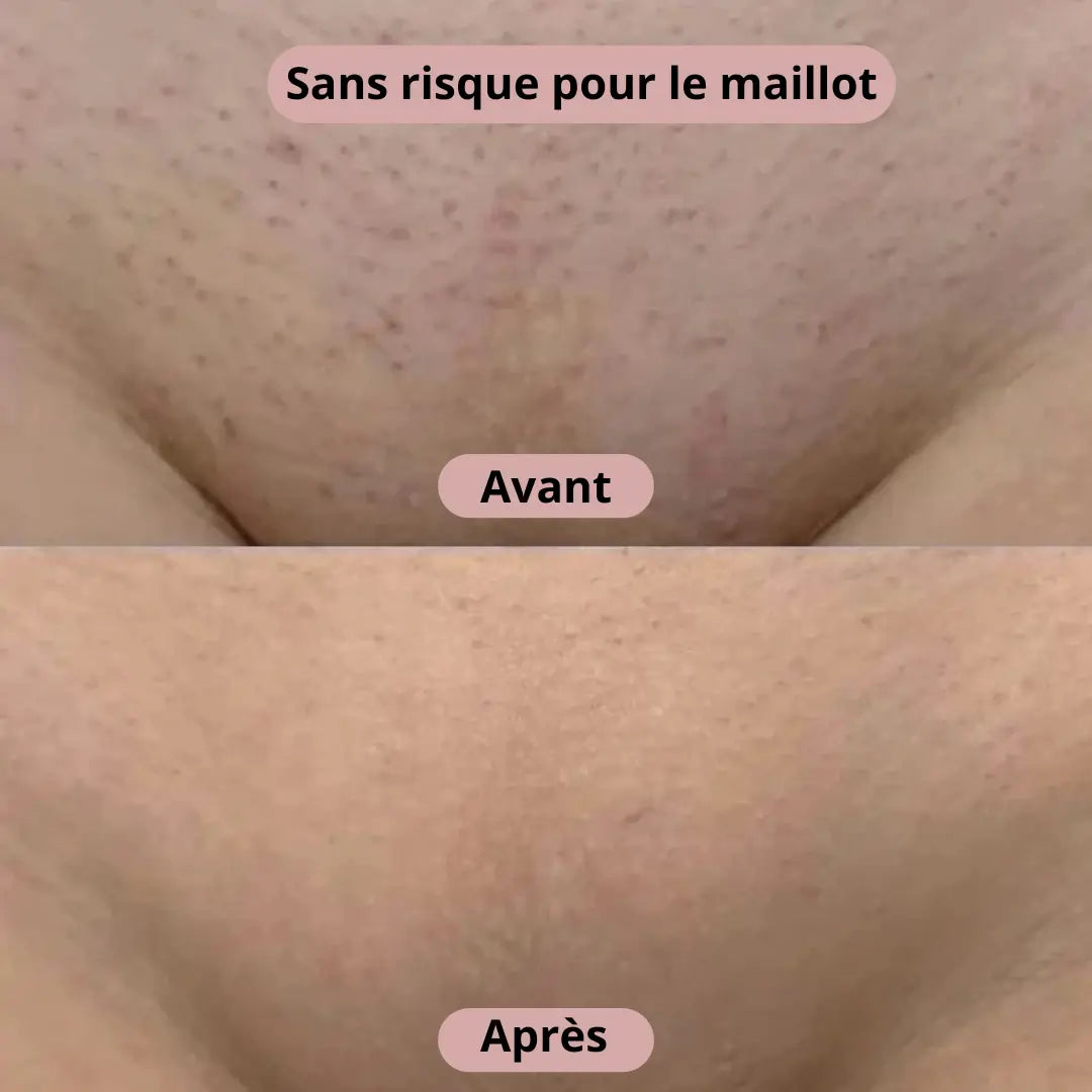 UNIVERSTRENDY® | Rasoir électrique 2 en 1 pour femme