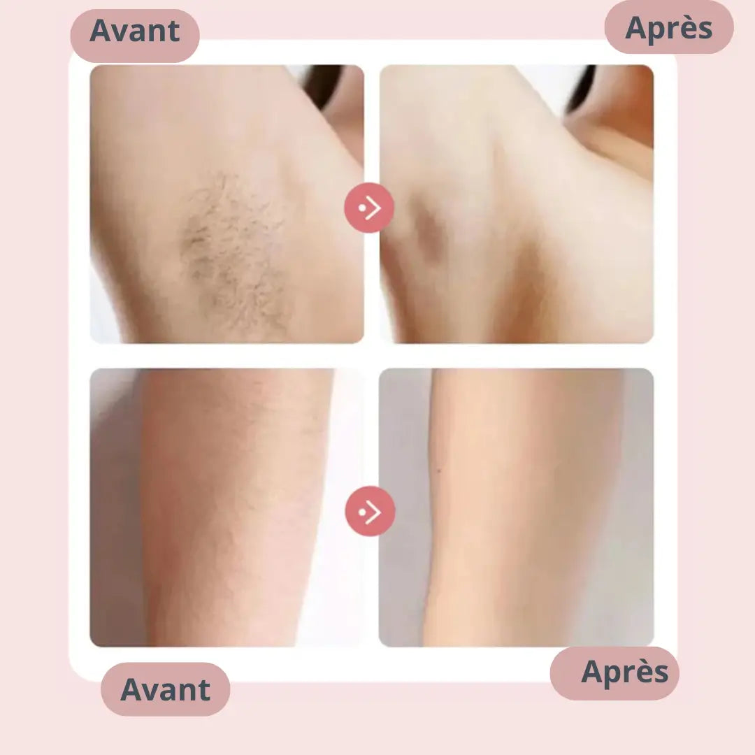 UNIVERSTRENDY® | Rasoir électrique 2 en 1 pour femme